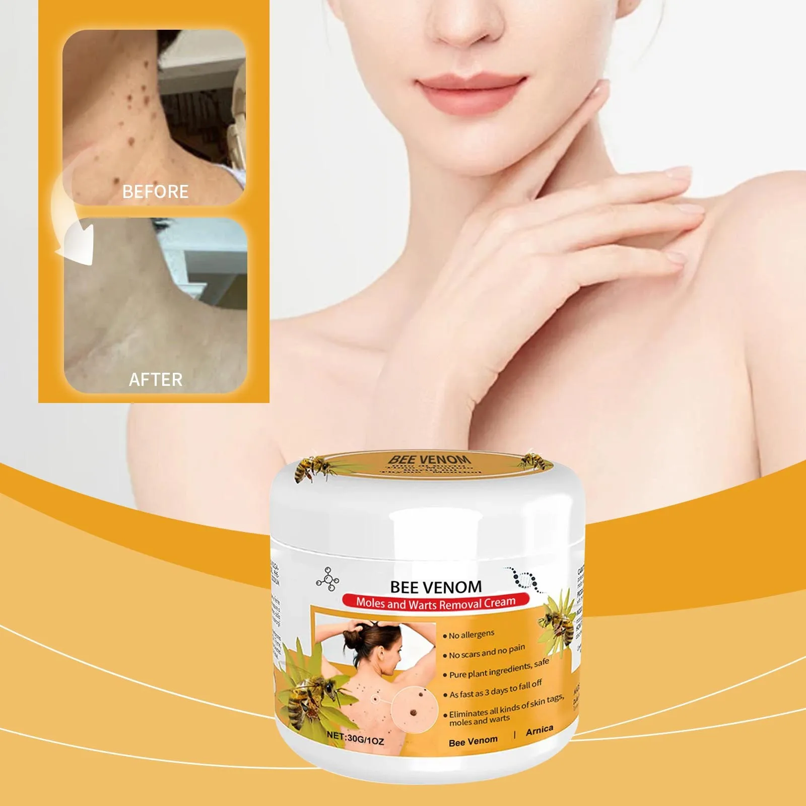 Wart Removing Care Lubricating And Rejuvenating Skin, Removing Warts And Moles Moisturizing Smooth Skin , Herbal Plant Mild,30ML